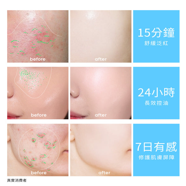 SKINTIFIC 5X神經醯胺保濕小藍霜30g滋潤版