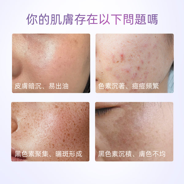 SKINTIFIC 377亮白保濕霜30g 377 Symwhite Moisturizer