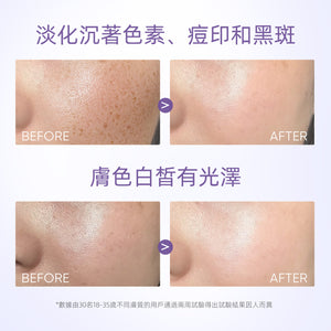 SKINTIFIC 377亮白保濕霜30g 377 Symwhite Moisturizer