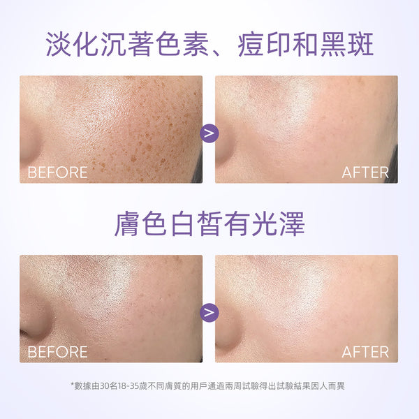 SKINTIFIC 377亮白保濕霜30g 377 Symwhite Moisturizer