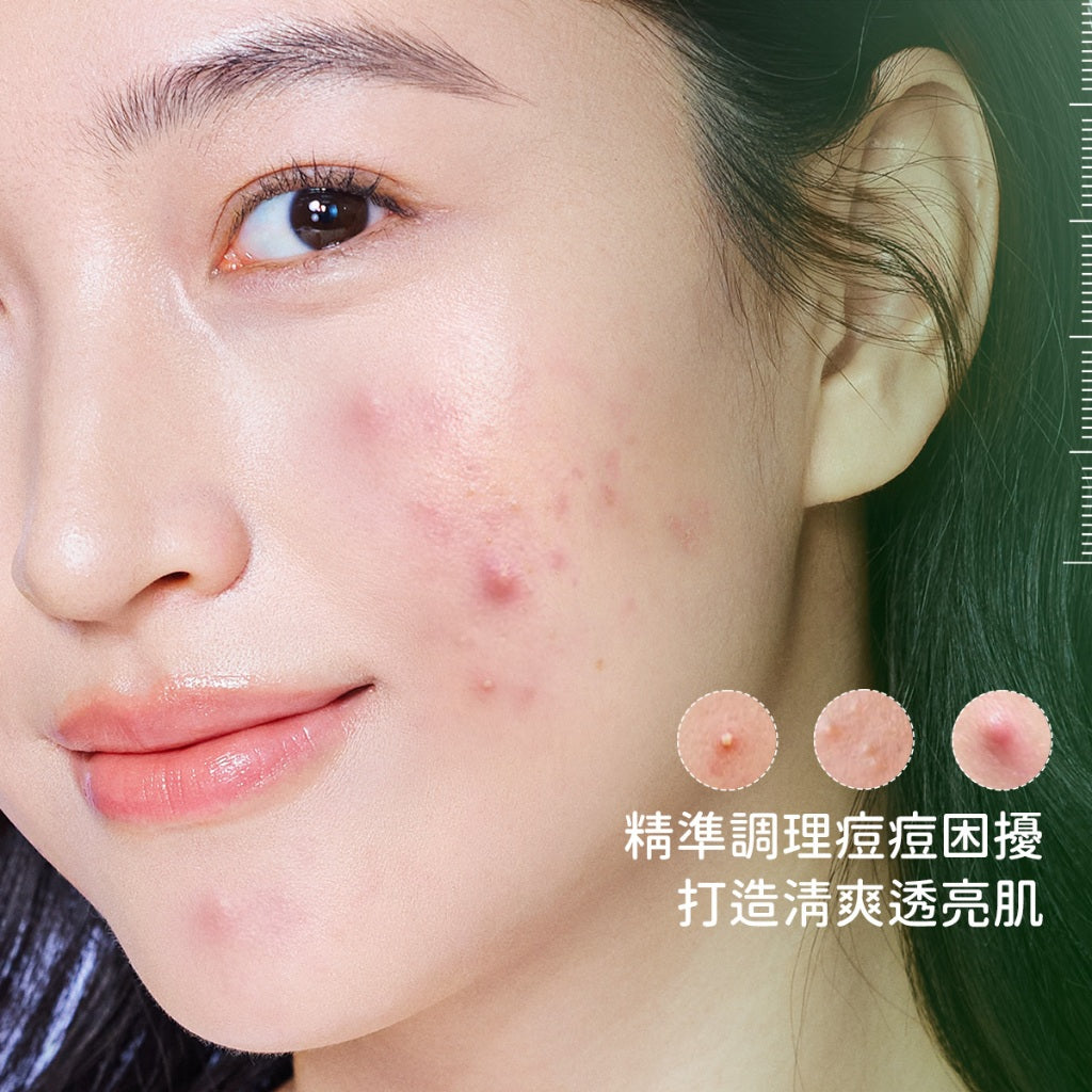淨痘精華舒緩調理液