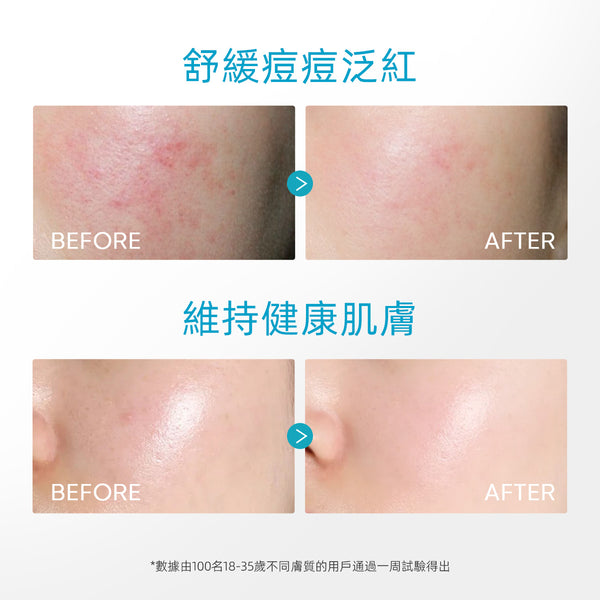 SKINTIFIC 5%泛醇舒緩凝膠45g Calming Moisturizer