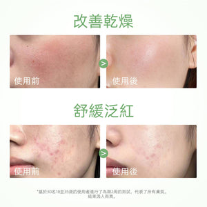SKINTIFIC 艾草舒緩泥膜棒40g Mugwort Clay Stick深層清潔控油