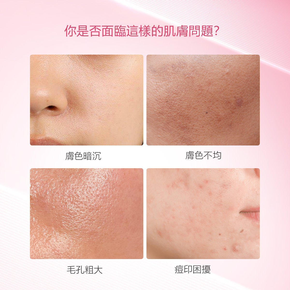 【三色泥膜組】淨化毛孔  平衡膚況
