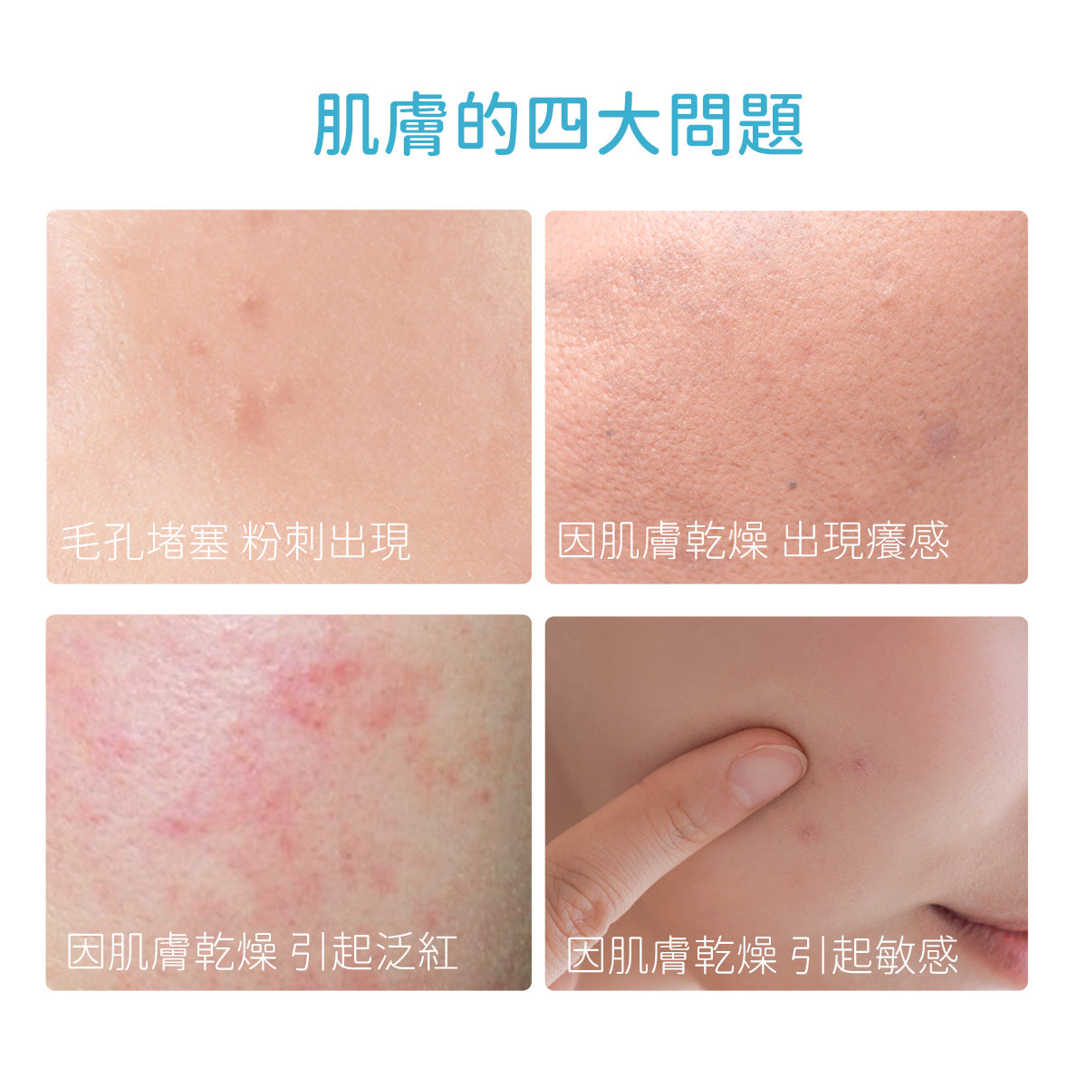【買一送一】5%泛醇舒緩凝膠