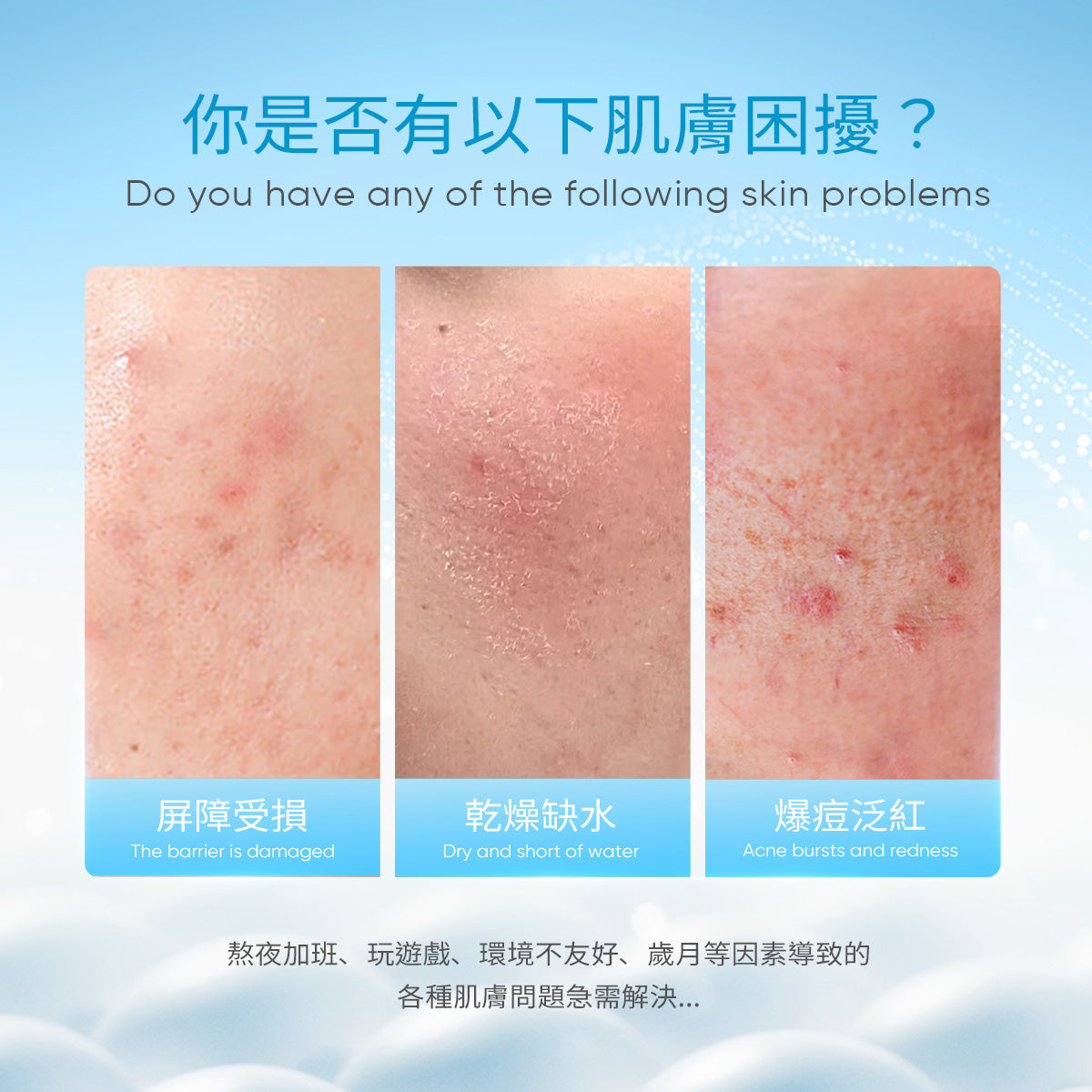 5X神經醯胺屏障修復系列