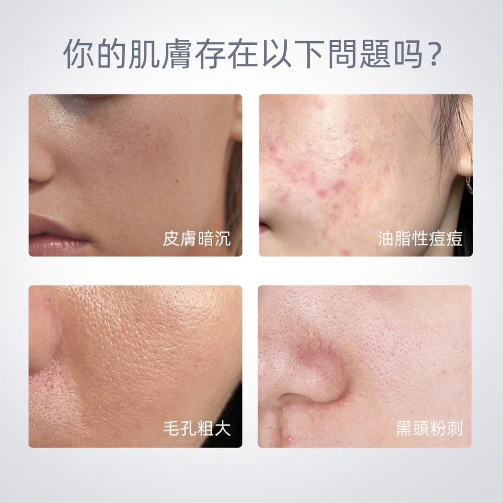 SKINTIFIC 火山泥黑頭粉刺清潔泥膜55g AHA益生菌 Volcano Clay Mask