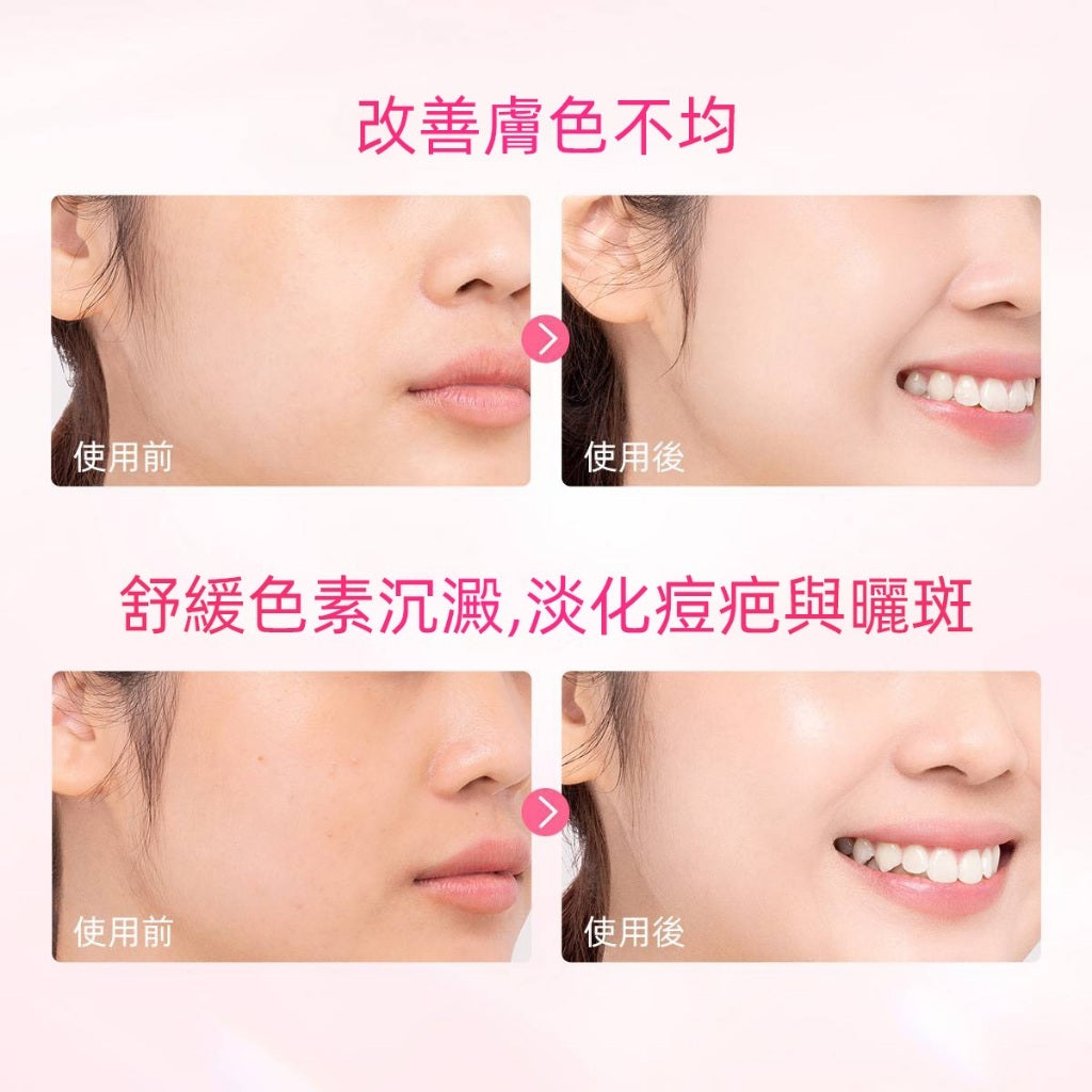 菸鹼醯胺亮白保濕霜