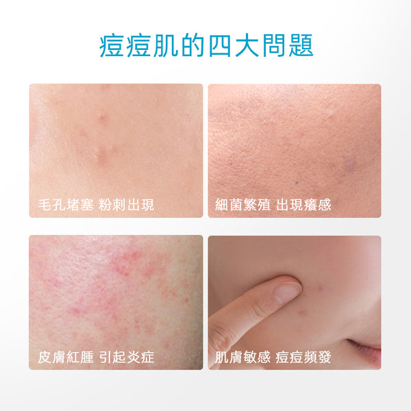 SKINTIFIC 5%泛醇舒緩凝膠45g Calming Moisturizer