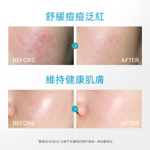 SKINTIFIC 5%泛醇舒緩凝膠45g Calming Moisturizer