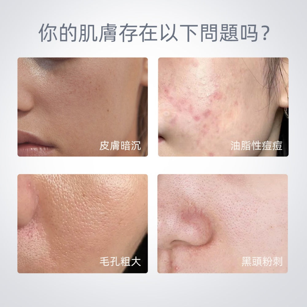 SKINTIFIC 火山泥潔淨泥膜棒40g Volcano Clay Stick