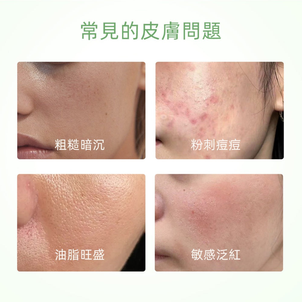 SKINTIFIC 艾草舒緩泥膜棒40g Mugwort Clay Stick深層清潔控油